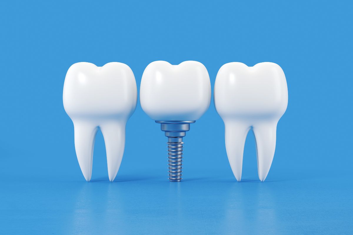 Struggling with Missing Teeth? Discover Solutions and Relief : A Complete Guide