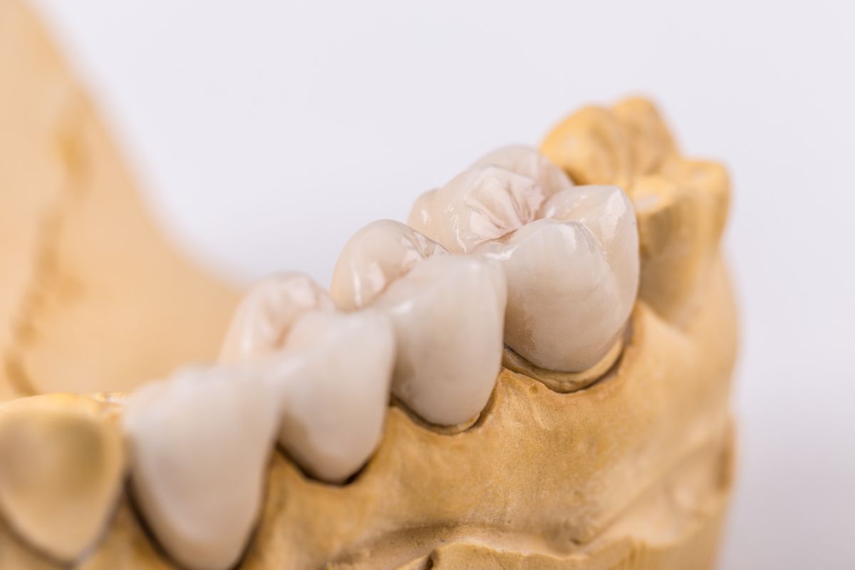 Debunking Common Myths About Endodontists in Cape Coral