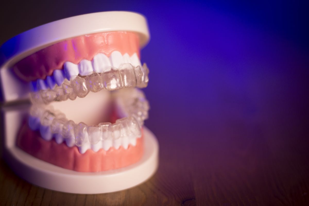 From Consultation to Completion: What Cape Coral Patients Can Expect During Their Invisalign Journey