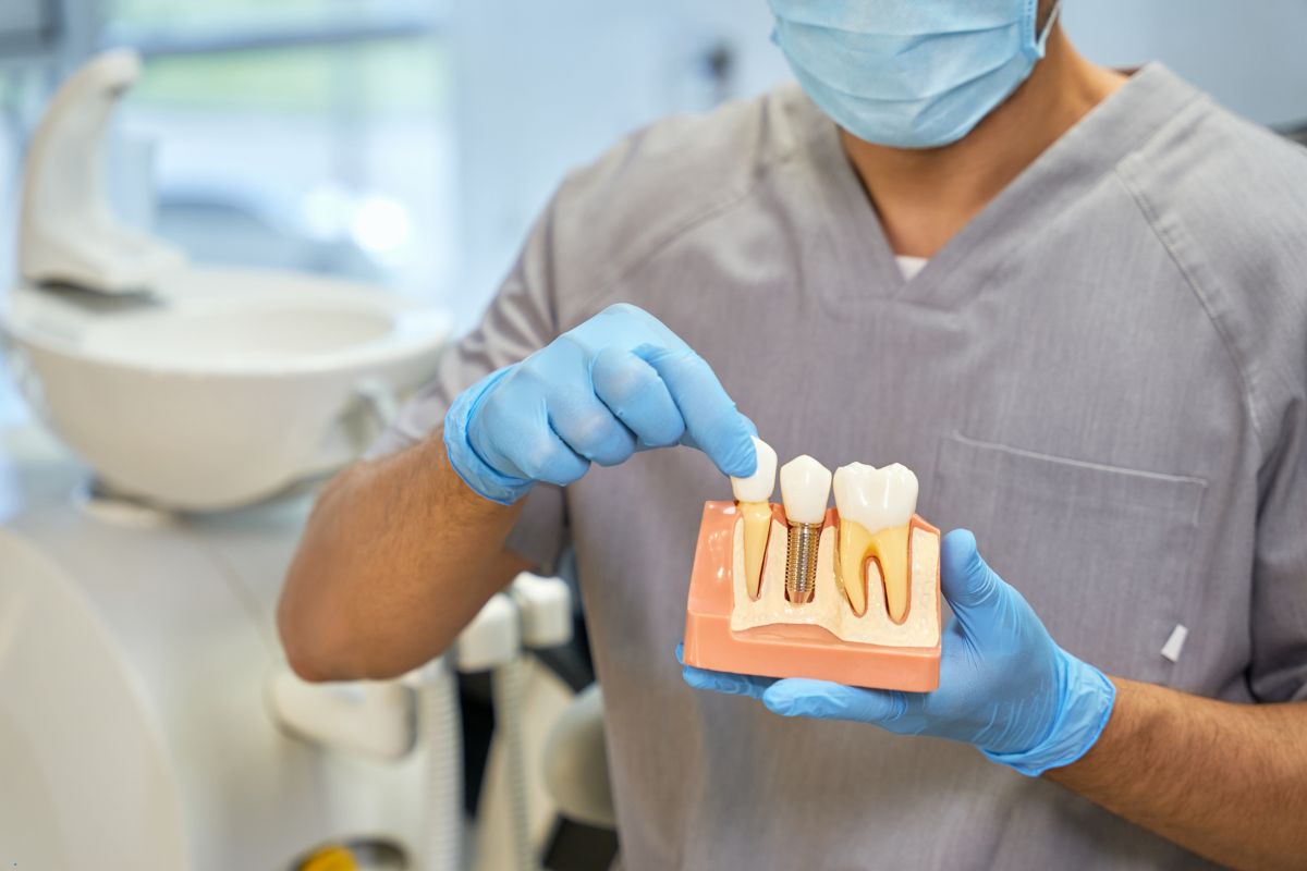 Are You a Candidate for Dental Implants? Find Out Here