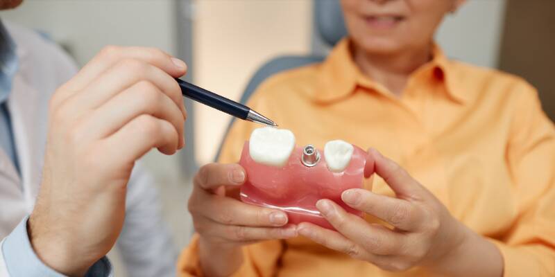 Common Dental Implant Complications and How to Avoid Them