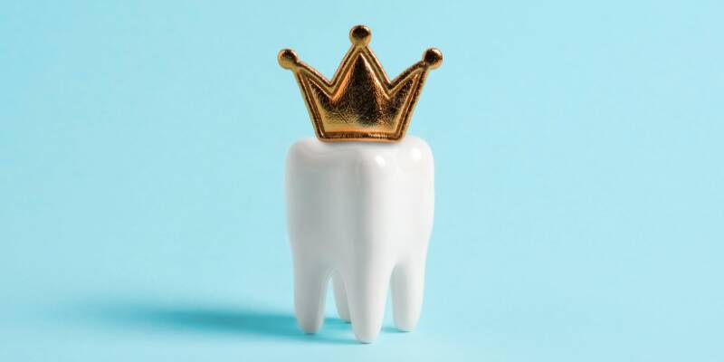 Crown Sensitivity After 2 Months: Guidance From a Cape Coral Dental Professional