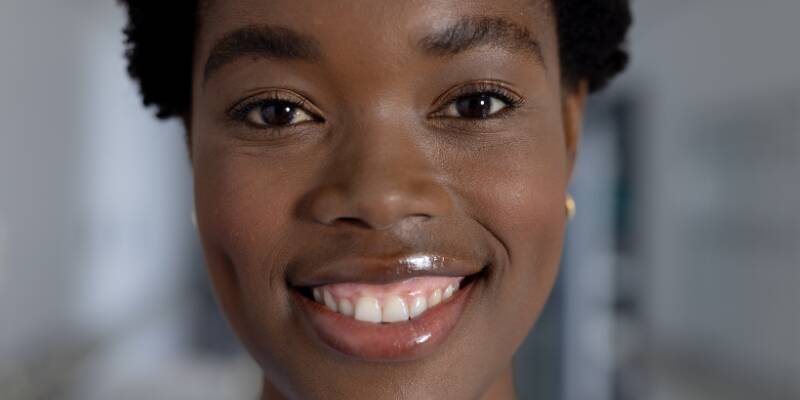 Simple Ways to Fix a Gummy Smile and Feel More Confident