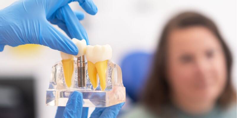 What Are Screwless Dental Implants and How Are They Different from Traditional Implants?