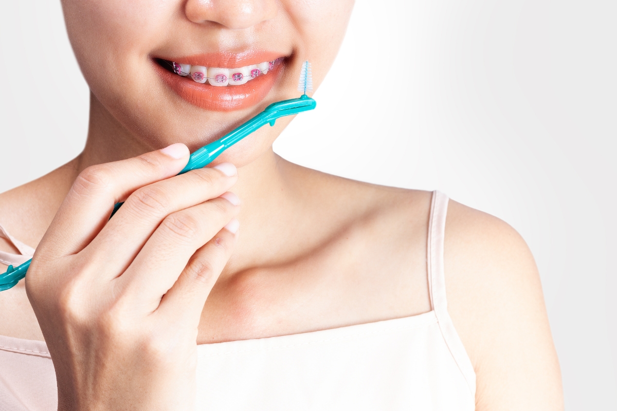 How to Safely Whiten Your Teeth While Wearing Braces?