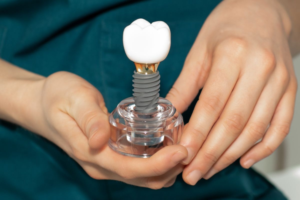 Can Your Body Reject a Dental Implant? Risks, Symptoms & Prevention
